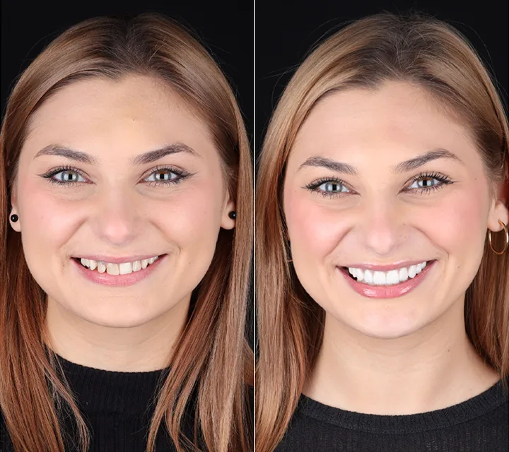 Transformation Image 1